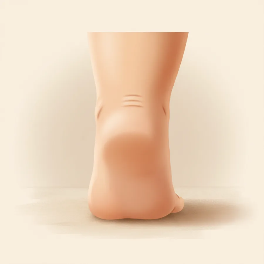 옆-뒤에서 본 통통한 맨발 한 짝, 둥근 발뒤꿈치(heel)를 화면 중앙에 크고 도드라지게 그린 그림